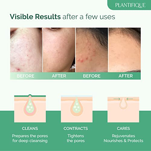 Face Masks Skincare Korean Skincare Clay Mask - 100% Vegan Face Mask with Avocado & Green Tea - Body Mud Mask - Face Masks Beauty - Face Masks Skin Care Dermatologically Tested by Plantifique