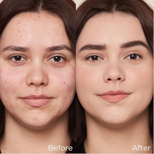 M. Asam Magic Finish Make-Up Mousse Classic (1.01 Fl Oz) – 4in1 Primer, Foundation, Concealer & Powder With Buildable Coverage, Hides Redness And Dark Spots, Vegan, For Light To Medium Skin Tones