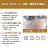 𝗣𝗥𝗘𝗠𝗜𝗨𝗠 Anti Ageing Eye Serum/Eye Cream for Dark Circles, Puffiness & Crows Feet - Anti Wrinkle Eye Serum - Reduces Wrinkles, Bags, Saggy Skin & Puffy Eyes! Eye Cream