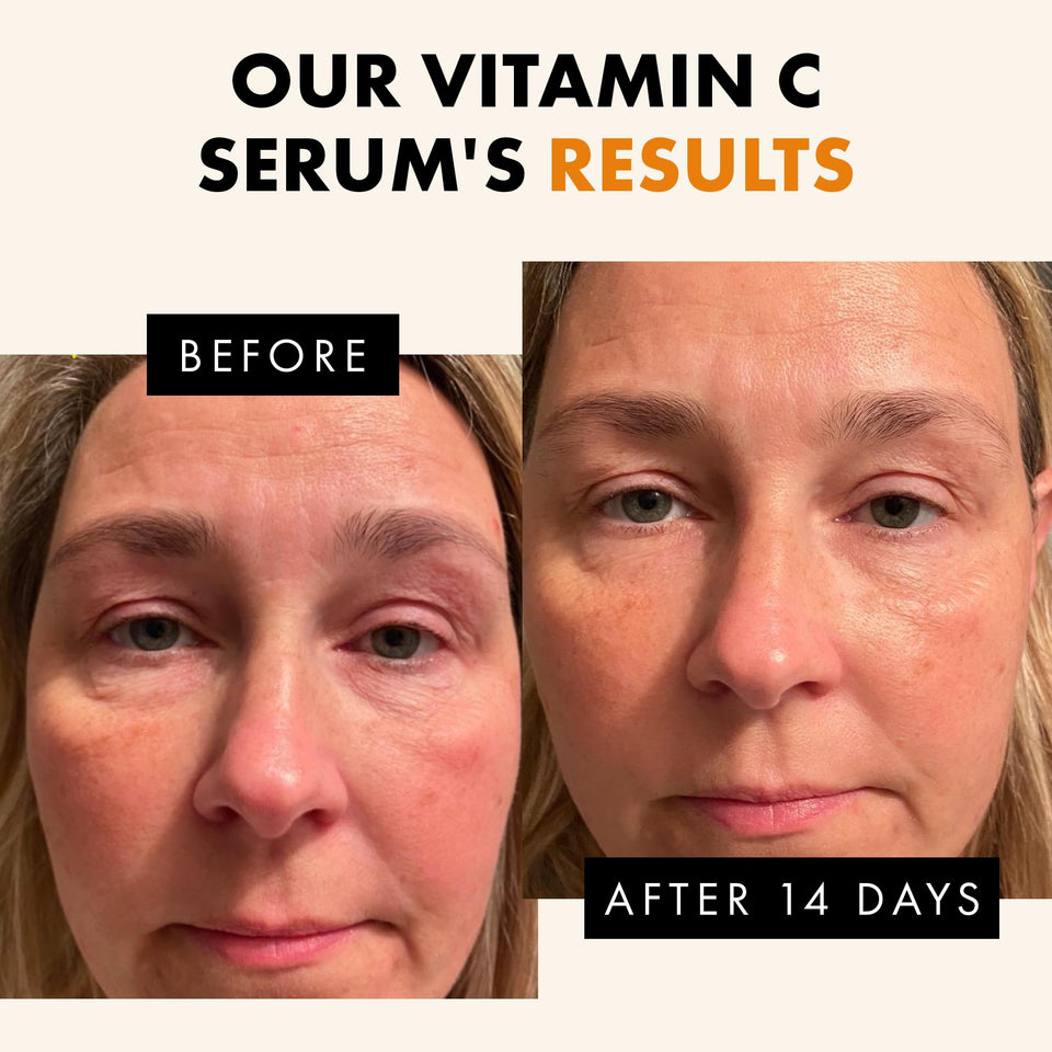Eclat Skincare Glow Up Vitamin C Serum - Vitamin C Serum for Face with Hyaluronic Acid, Ferulic Acid & Vit E - Skin Brightening Face Care - Anti Aging, Hydrating & Dark Spot Lightening 30ml