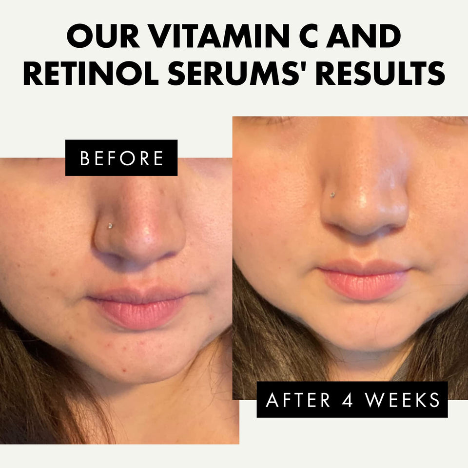Eclat Skincare Glow Up Vitamin C Serum - Vitamin C Serum for Face with Hyaluronic Acid, Ferulic Acid & Vit E - Skin Brightening Face Care - Anti Aging, Hydrating & Dark Spot Lightening 30ml