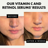 Eclat Skincare Glow Up Vitamin C Serum - Vitamin C Serum for Face with Hyaluronic Acid, Ferulic Acid & Vit E - Skin Brightening Face Care - Anti Aging, Hydrating & Dark Spot Lightening 30ml