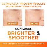 L'Oréal Paris Revitalift Clinical vitamin C serum results graphic with before-and-after skin panels and brighter, smoother skin claims