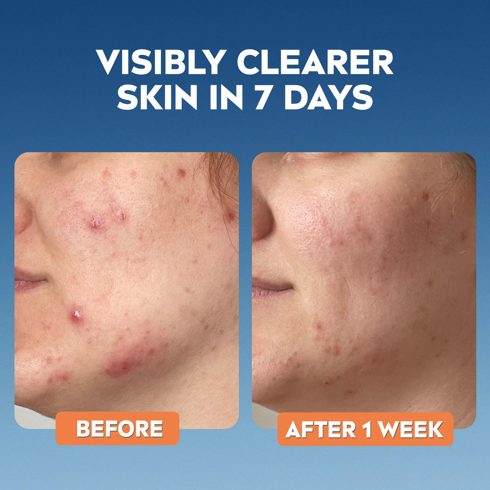 NIVEA Derma Skin Clear Scrub skincare results graphic showing before and after one week, with visibly clearer skin