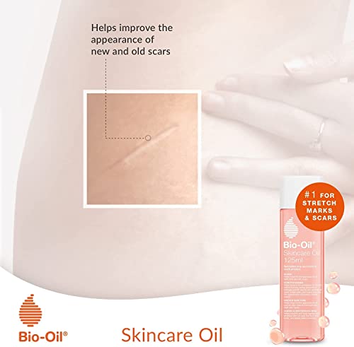 Bio-Oil Skincare Oil - Improve the Appearance of Scars, Stretch Marks and Skin Tone