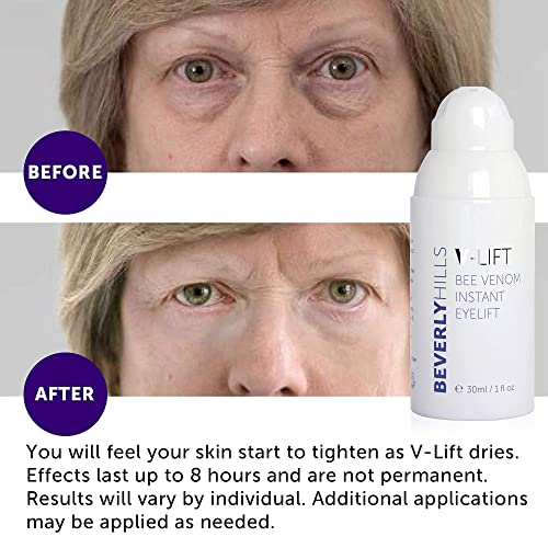 BEVERLY HILLS V-Lift Instant Eye Lift and Eye Tuck Bee Venom Serum for Treating Puffy Eyes, Dark Circles, and Wrinkles